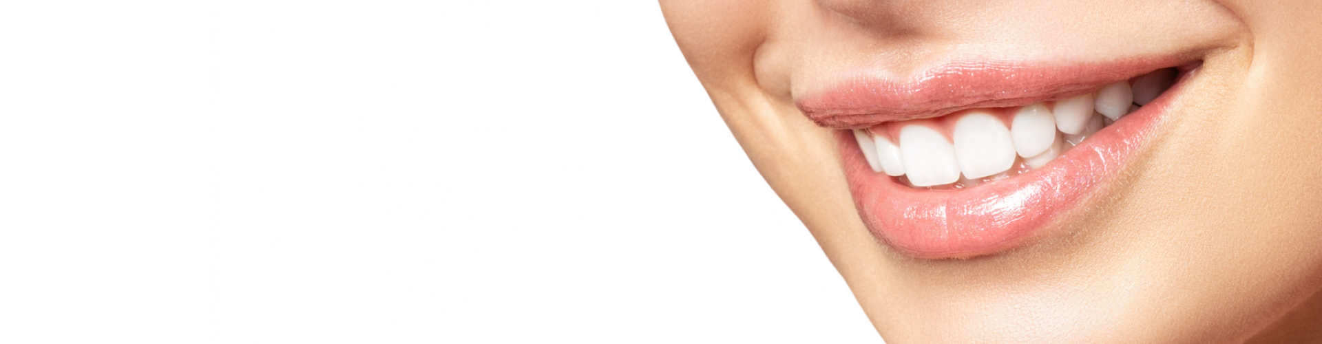 Close-up of a bright, white smile after dental whitening or porcelain veneers treatment.